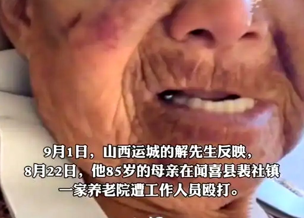 山西闻喜一养老院发生恶性虐老事件 85 岁老人遭院长母亲殴打致多处骨折​
